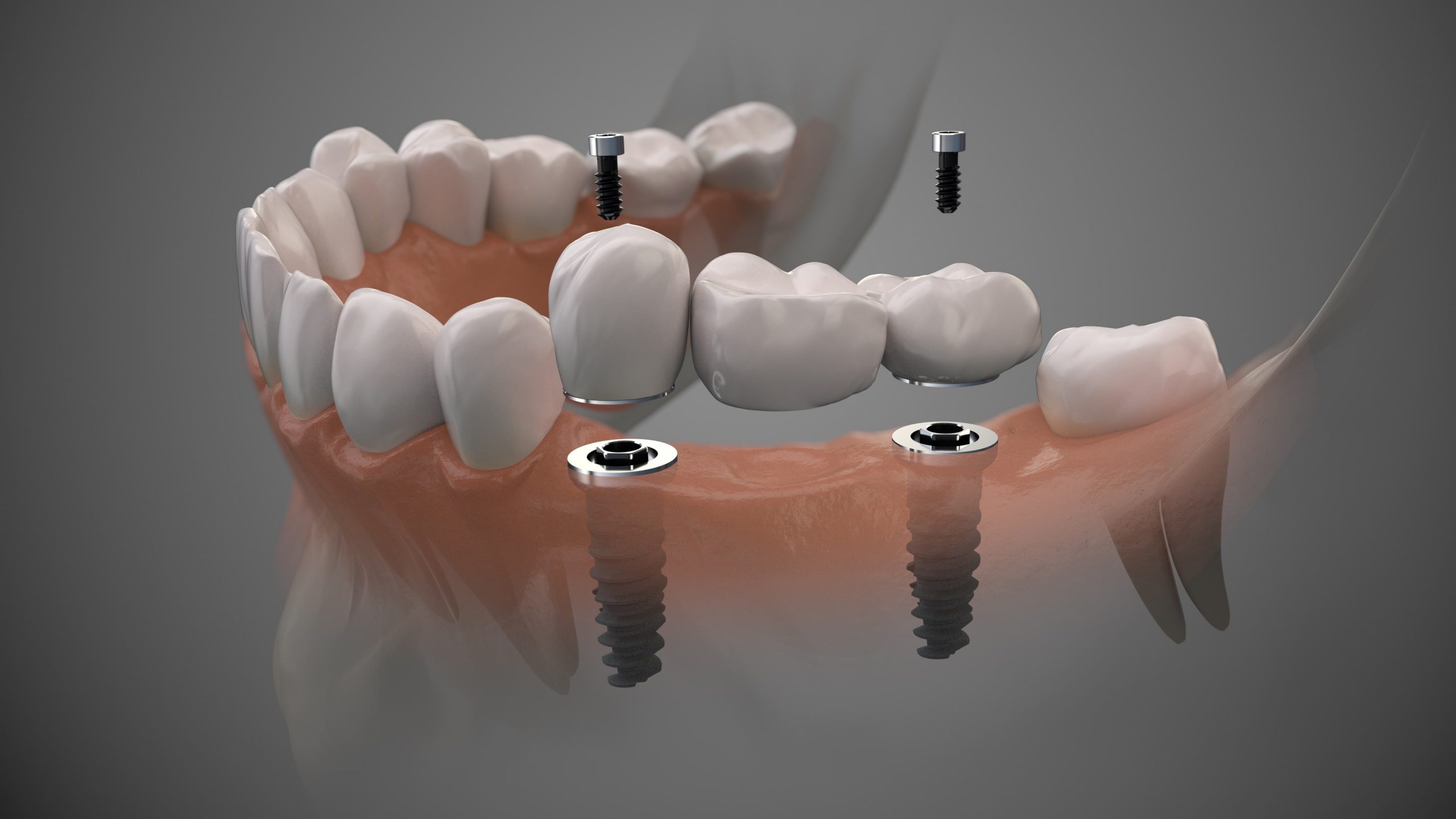 Restorative Dentistry
