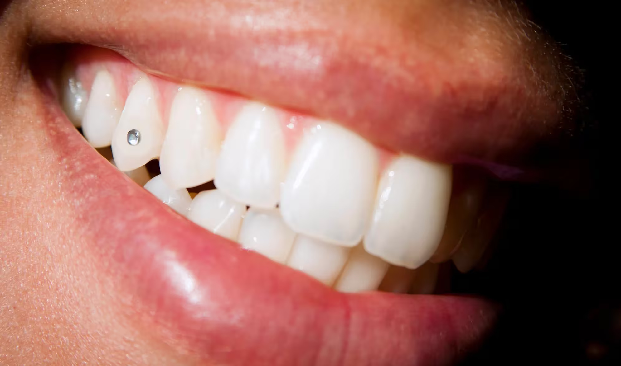 tooth-gem-133893522
